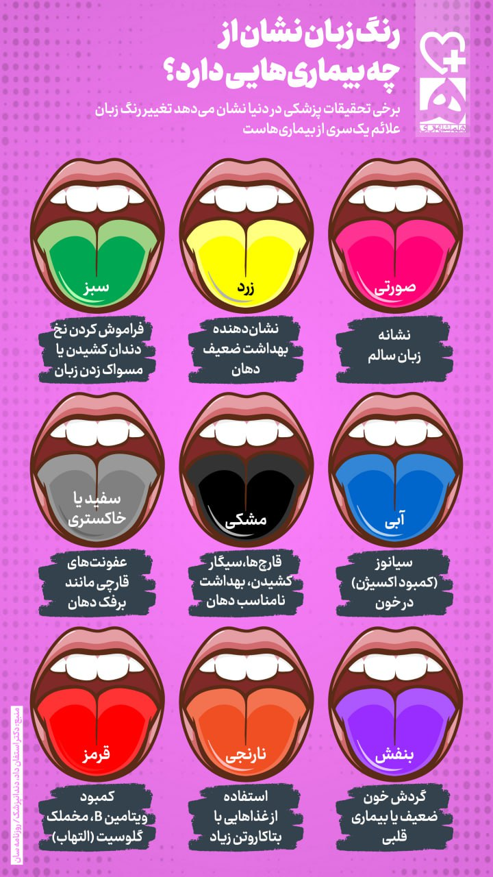 اینفوگرافیک/ رنگ زبان شما درباره سلامتیتان چه میگوید؟