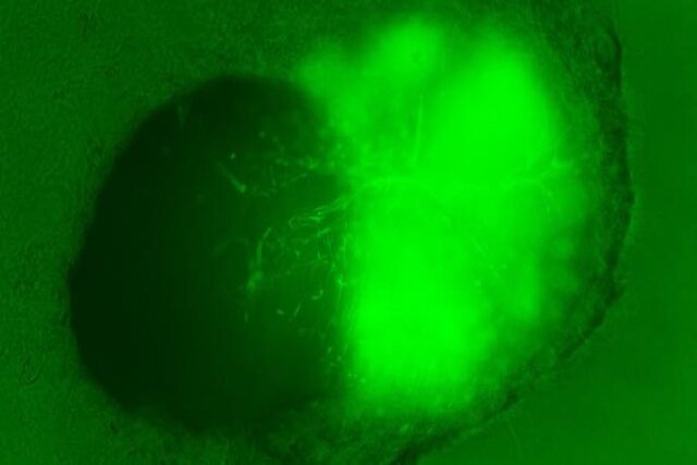 اولین مینی مغز جهان با سد خونی مغزی ایجاد شد
