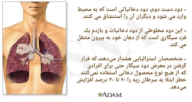 ژِستی که به قیمت جان تمام میشود