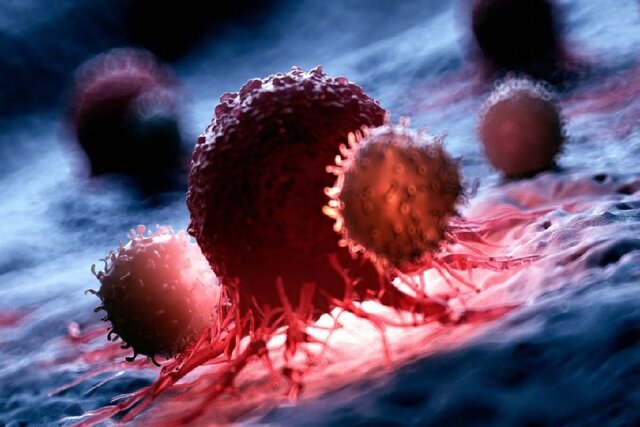 پایان کارآزمایی بالینی روی نانوداروی ضدسرطان حاوی RNA پایان کارآزمایی بالینی روی نانوداروی ضدسرطان حاوی RNA
