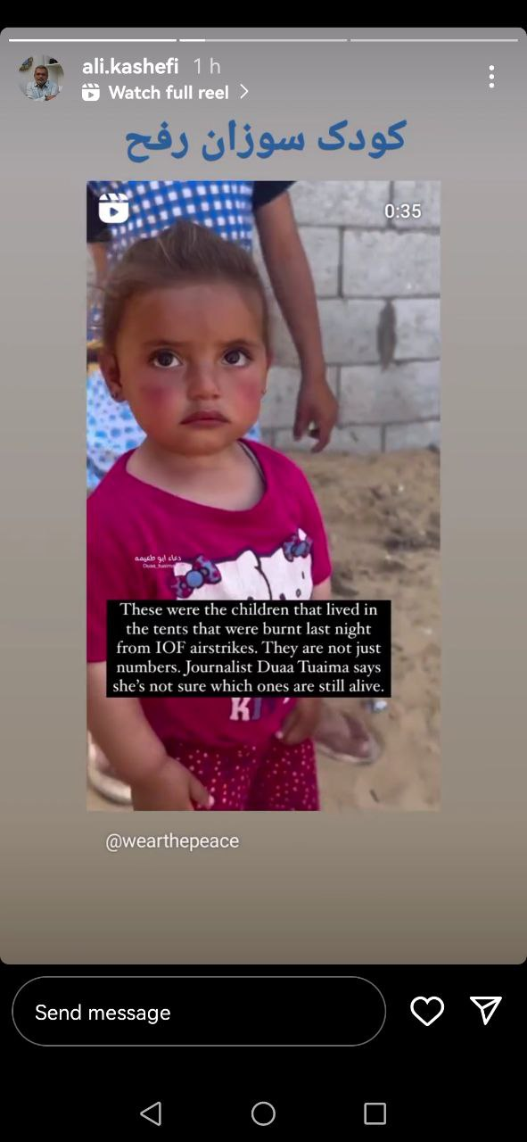 غزه میان بهت بشر شعله میکشد