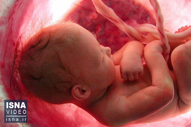 ویدیو/ موسسهای که «امید» آفرید؛ رویان ۳۳ ساله شد ویدیو/ موسسهای که «امید» آفرید؛ رویان ۳۳ ساله شد