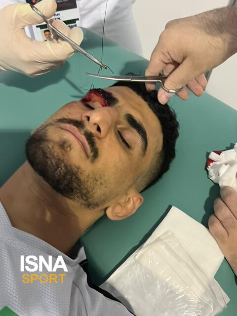 ابروی ملیپوش کشتی ایران پاره شد + عکس و فیلم