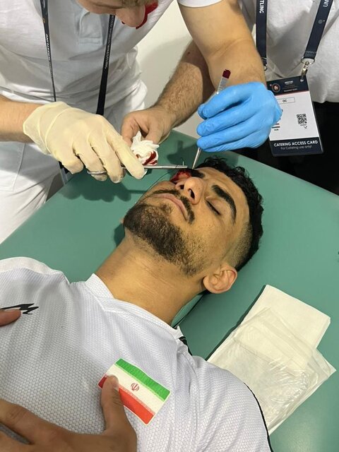 ابروی ملیپوش کشتی ایران پاره شد + عکس و فیلم