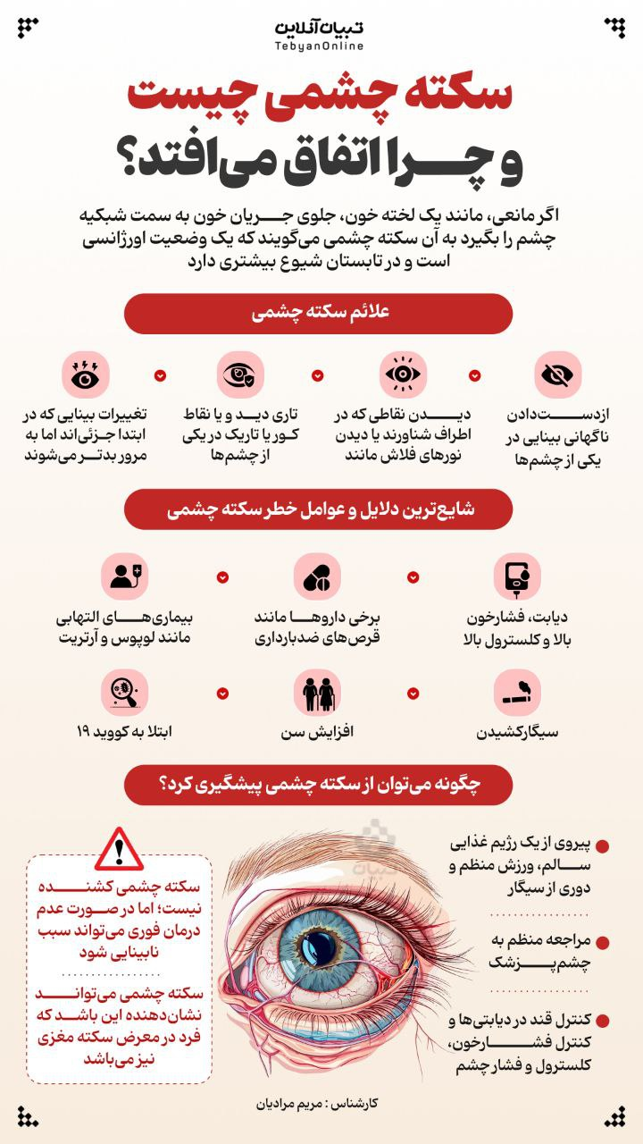 اینفوگرافیک/سکته چشمی چیست و چرا اتفاق می‌افتد؟ 