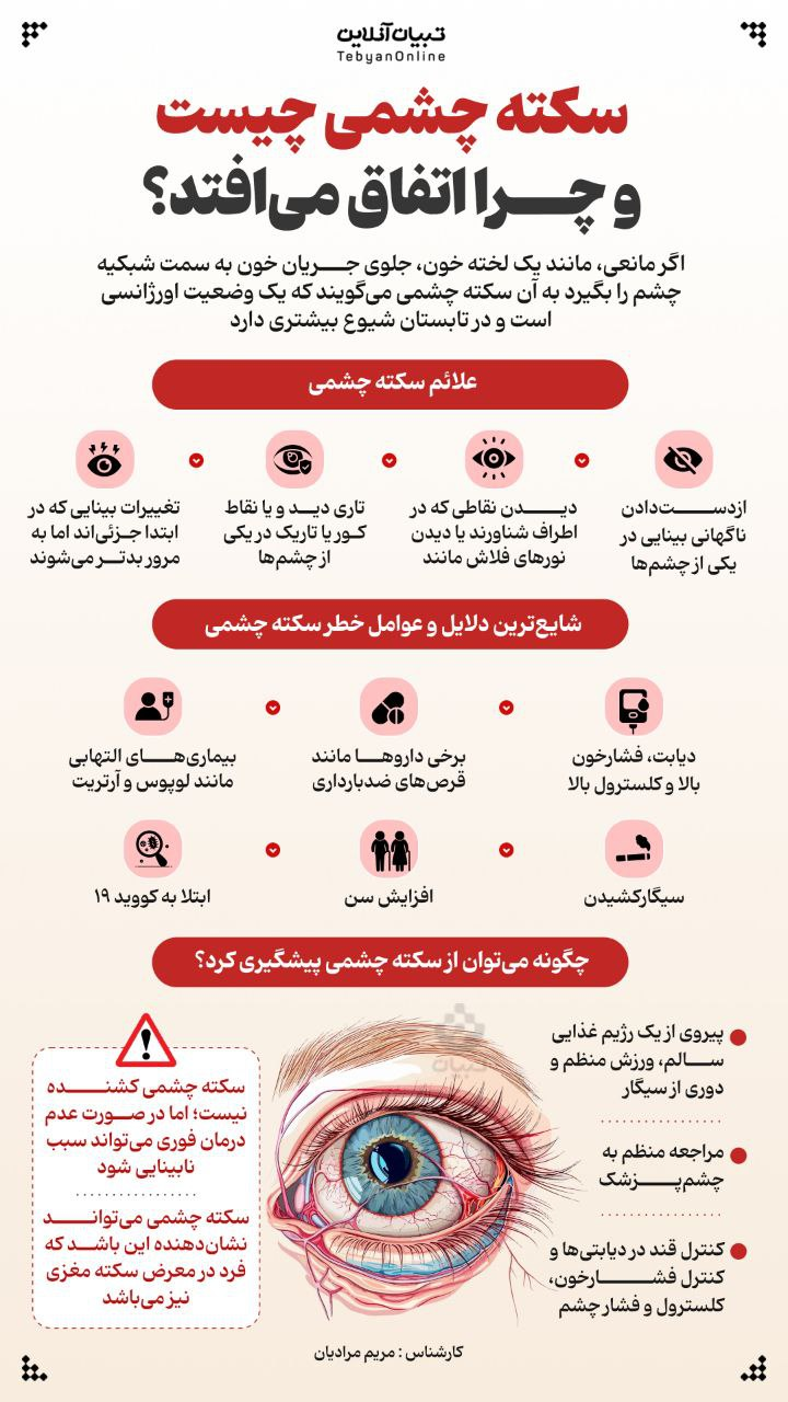 اینفوگرافیک/سکته چشمی چیست و چرا اتفاق میافتد؟
