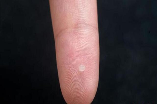 این حسگر ژلی میتواند سرطان و ضربه مغزی را تشخیص دهد این حسگر ژلی میتواند سرطان و ضربه مغزی را تشخیص دهد