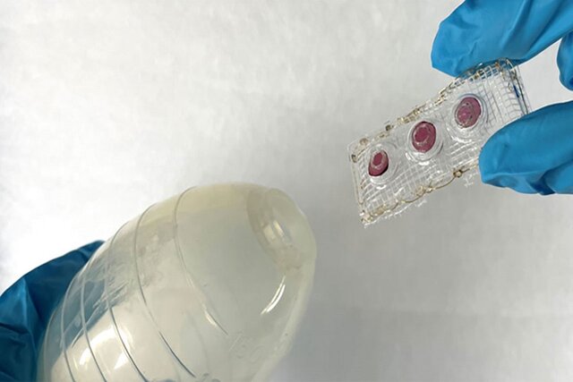 نشت مایعات در سیستم گوارش بعد از عمل قابل تشخیص میشود نشت مایعات در سیستم گوارش بعد از عمل قابل تشخیص میشود