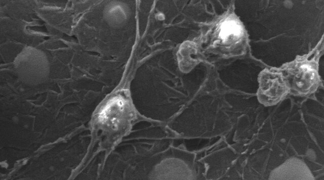 درمان آسیب نخاعی با یک برچسب