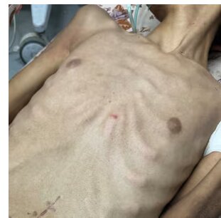 افشاگری گاردین از سلاحهای اسرائیلی که برای کشتار حداکثری ساخته شده