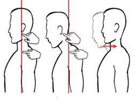 چند حرکت اصلاحی برای درمان قوز گردن
