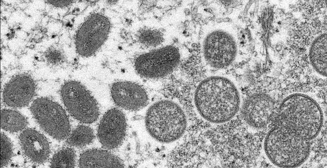 ظهور سویه کشندهتر «آبله میمونی» در آفریقا؛ تغییر نحوه انتقال ویروس و افزایش مبتلایانِ بدون علامت