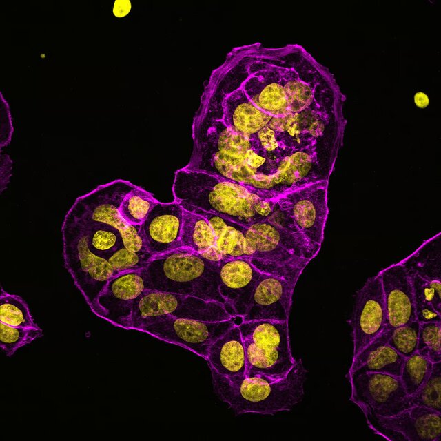 اعلام برندگان مسابقه عکاسی علمی ۲۰۲۴؛ هنگامی که علم و هنر ملاقات میکنند