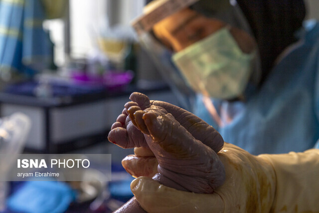 خودکفایی کشور در حوزه پزشکی / راهکارهای غیراصولی و ضعف در نگهداشت نیروی پزشکی