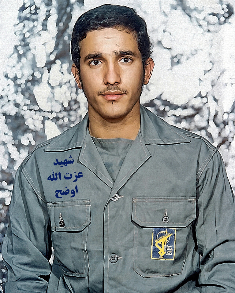 این شهید با نصف ابدنش جنگید