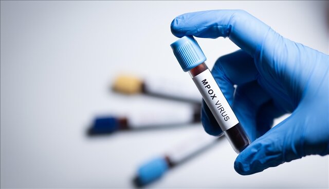 سازمان جهانی بهداشت: «ام پاکس» در کشورهای بیشتری شناسایی شده است سازمان جهانی بهداشت: «ام پاکس» در کشورهای بیشتری شناسایی شده است