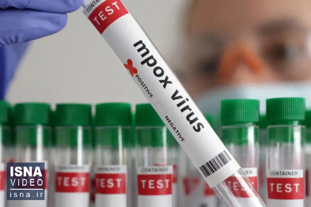 ویدیو/ تایید اولین تست فوری «آبله میمون» توسط سازمان بهداشت جهانی ویدیو/ تایید اولین تست فوری «آبله میمون» توسط سازمان بهداشت جهانی