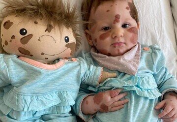 «عروسکهای معلول» را میتوان وارد دنیای کودکان کرد؟