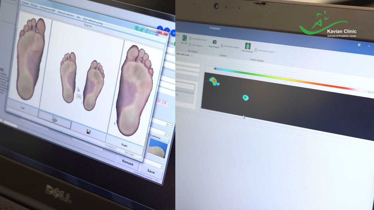 کلینیک کاویان با اسکن کف پا و ساخت کفی‌های طبی تخصصی در تهران