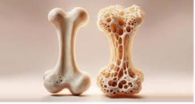 استخوانها در پاسخ به فعالیت فیزیکی، قویتر میشوند استخوانها در پاسخ به فعالیت فیزیکی، قویتر میشوند