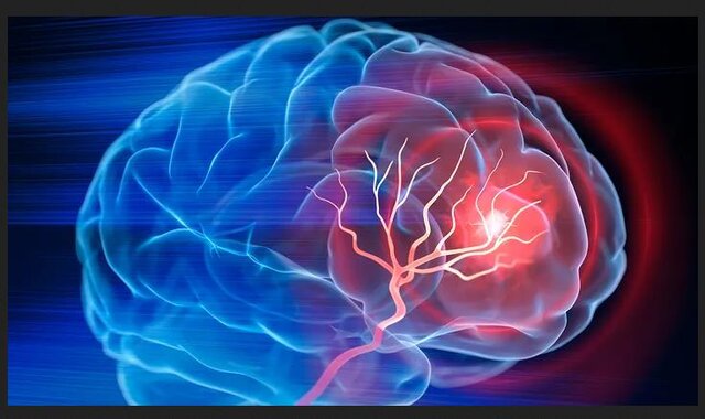 عکس تزیینی است. ۴ ساعت نخست؛ زمان طلایی نجات بیماران سکته مغزی