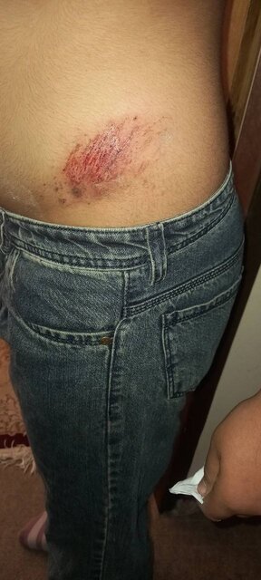 حمله سگهای ولگرد به یک دانش آموز