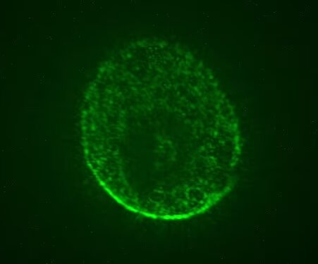 کشف درمان آلزایمر و پارکینسون با کمک مغزهای پرورشیافته در فضا