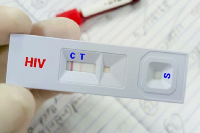 درمان «ایدز» رایگان است/ ویروس HIV قابل کنترل است به شرط درمان درمان «ایدز» رایگان است/ ویروس HIV قابل کنترل است به شرط درمان