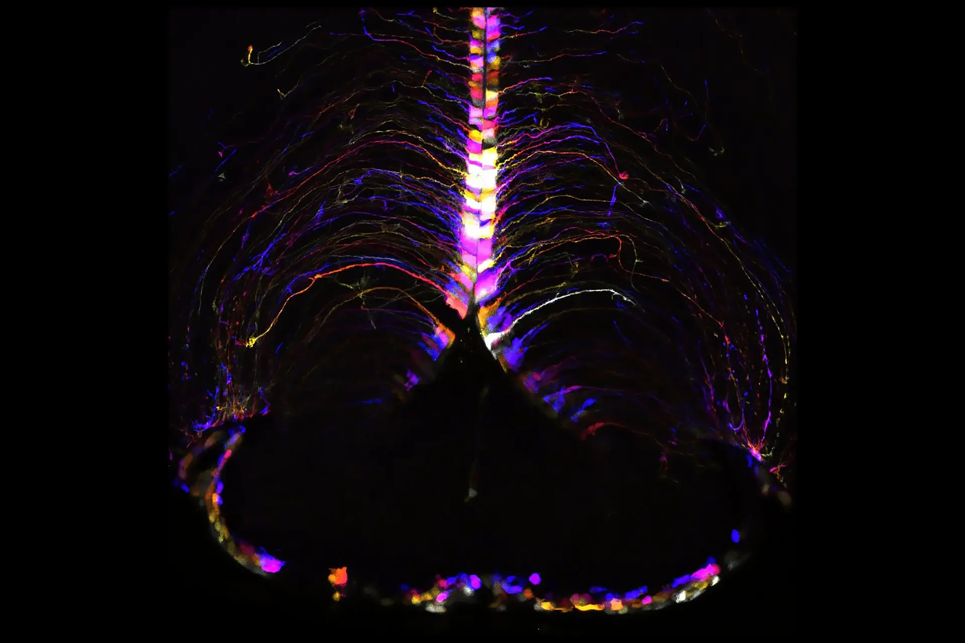 افزایش سن، برخی از سلولهای مغز را بیشتر از سایرین تغییر میدهد