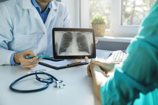 عکس تزیینی است. سرطان ریه؛ شایع و با مرگومیر بالا / ارتباط سیگار با ۱۰ سرطان