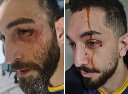 کتککاری در لیگ برتر والیبال + ویدیو کتککاری در لیگ برتر والیبال + ویدیو