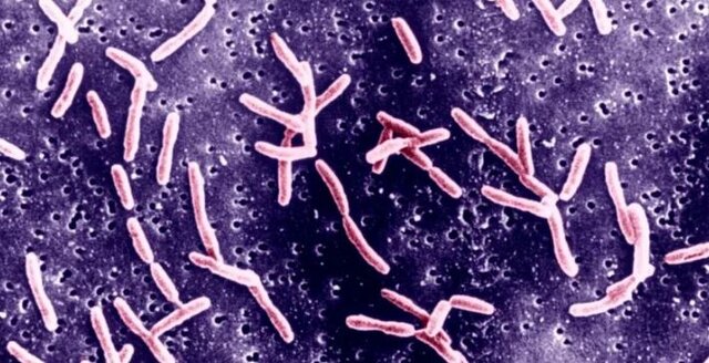 عکس: گتی ایمجز «سندرم گیلن باره»: هند با شیوع یک بیماری فلجکننده روبروست