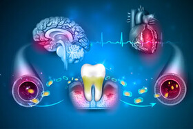 ویدیو/ آیا باکتری‌های دهان بر زوال عقل تاثیر دارند؟