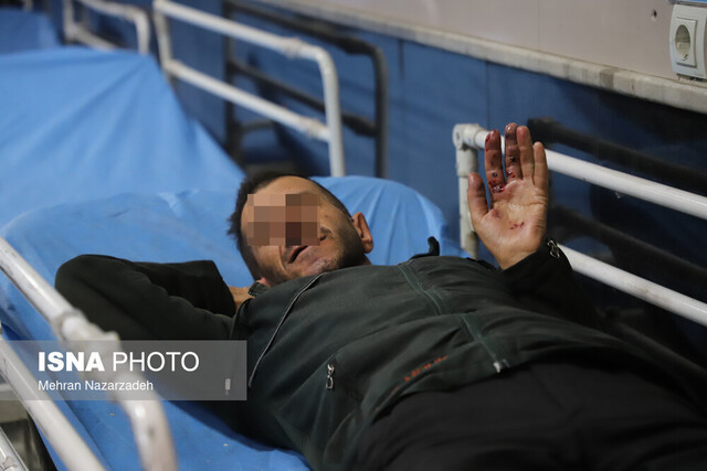 عکس تزیینی آسیب ۱۸۰ نفر همراه با یک نقص عضو در چهارشنبه سوری امسال