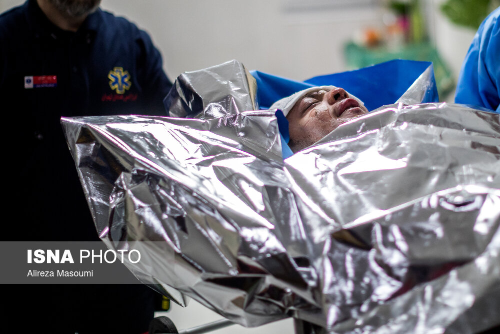 ۱۲۸ قربانی بی‌احتیاطی خانگی در سنندج/ ۹۰ درصد نیازمند پیوند پوست هستند