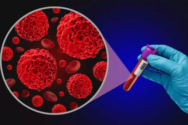 ویدیو/ پیشگیری ۵۰ درصدی از سرطانها با غربالگری ویدیو/ پیشگیری ۵۰ درصدی از سرطانها با غربالگری