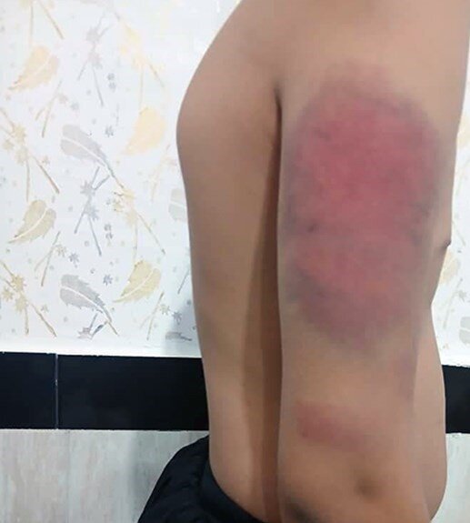 خشونت شوکهآور معلم سنندجی/ ضرب و شتم دانشآموزان با کابل