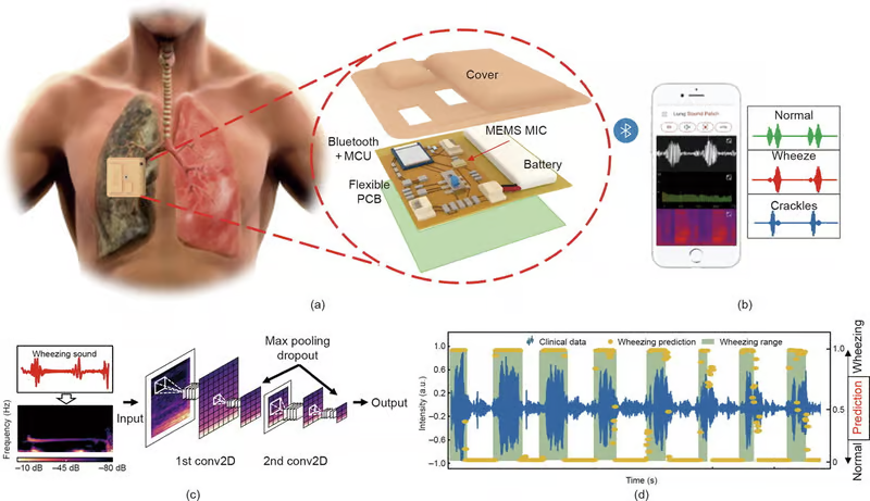 این گوشی پزشکی روی قفسه سینه میچسبد و مشکلات تنفسی را تشخیص میدهد