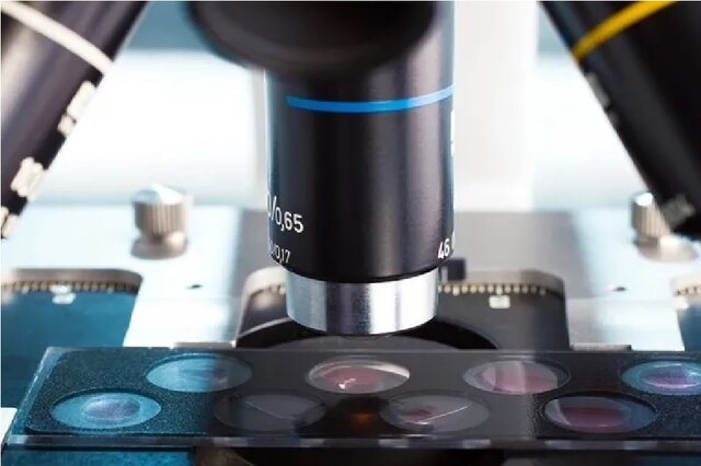 تشخیص سلولهای سرطانی و سالم از طریق تحلیل حرکت آنها تشخیص سلولهای سرطانی و سالم از طریق تحلیل حرکت آنها