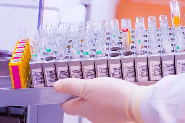 عکس تزئینی است پردازش دقیق و سریع نمونههای آزمایشگاهی با فناوری بومی