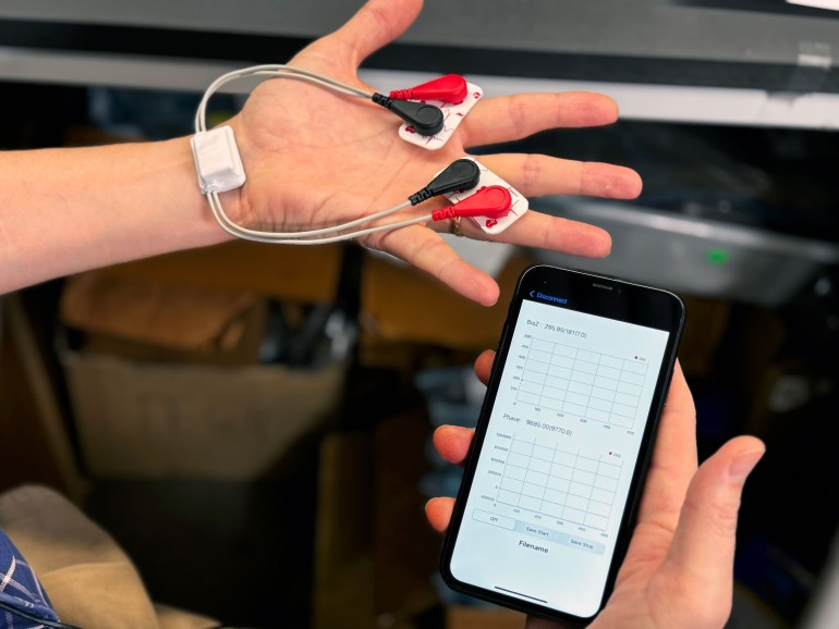 اندازهگیری میزان مصرف شیر مادر توسط نوزاد با یک دستگاه ساده