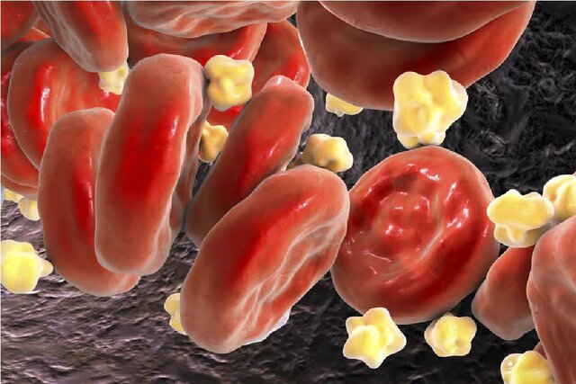 کاهش ۴۹ درصدی «کلسترول بد» خون با ترکیب دو دارو کاهش ۴۹ درصدی «کلسترول بد» خون با ترکیب دو دارو