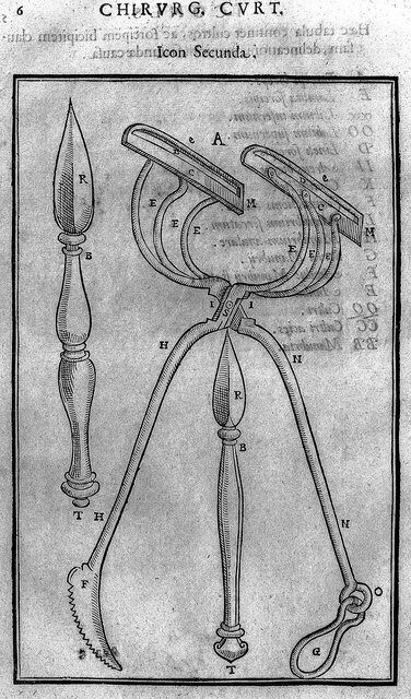 تاریخچه عملهای زیبایی/ اولین جراحی زیبایی تاریخ کِی انجام شد؟