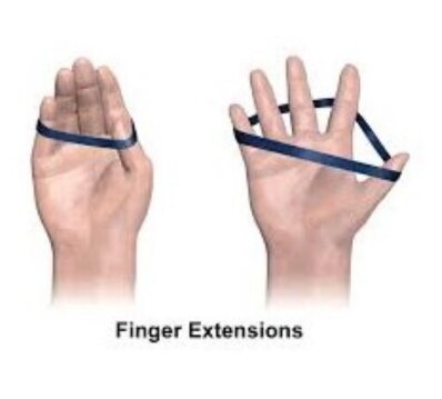 انگشت ماشهای و ۴ حرکت اصلاحی