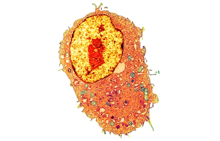 هوش مصنوعی، طراح پروتئین میشود!