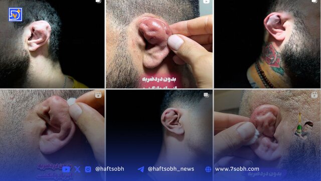چند می‌گیری گوش بشکنی؟