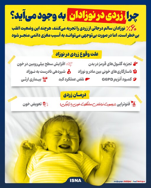 اینفوگرافیک/ چرا زردی در نوزادان به وجود میآید؟
