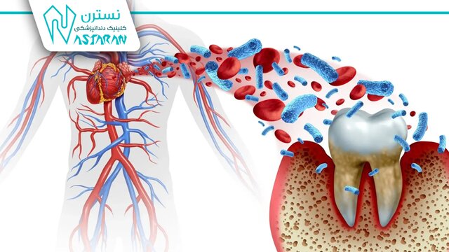 نگاهی علمی به تأثیر درمانهای نوین دندانپزشکی بر سلامت عمومی بدن نگاهی علمی به تأثیر درمانهای نوین دندانپزشکی بر سلامت عمومی بدن