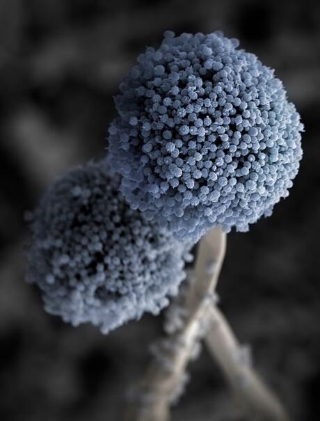 تغییرات اقلیمی، عامل گسترش قارچهای بیماریزا در انسان