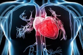 تولید سیم‌ بخیه زیست‌سازگار برای اعمال جراحی باز قلب